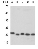 Anti-ZNF695 Antibody