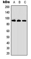 ARPP21 antibody