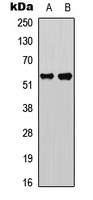 Caspase 8 p18 antibody