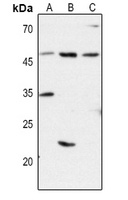 Anti-CD1d Antibody