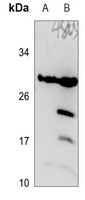 DHRS11 antibody