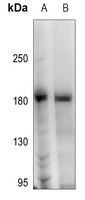 Anti-HER2 (Phospho-Y1248) Antibody
