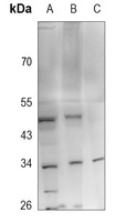 Anti-FGF13 Antibody