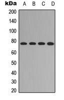 Anti-FOXO1 (Phospho-S329) Antibody