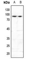 Anti-FOXO3 (Phospho-S253) Antibody