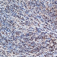 FOXP1 Rabbit Polyclonal Antibody