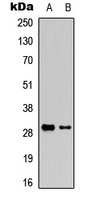 Anti-Granzyme K Antibody
