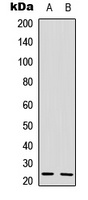 Anti-IL-22 Antibody