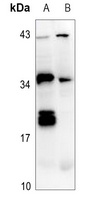 Anti-IL-26 Antibody