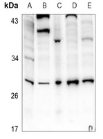 Anti-IL-6 Antibody