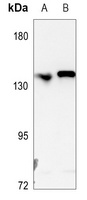 L1CAM antibody