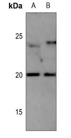 CD306 antibody