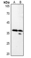 LASP1 antibody