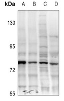 Anti-TAK1 (Phospho-T187) Antibody