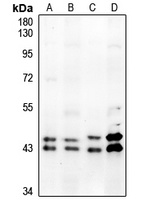 Anti-ERK1/2 (Phospho-T202/Y204) Antibody