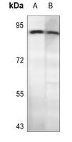 Anti-CD56 Antibody