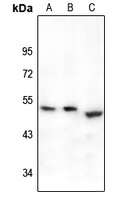 Prostaglandin E synthase 2 antibody