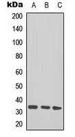 TAL1/2 (AcK221+222/K36+37) antibody