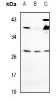 Anti-VTI1A Antibody