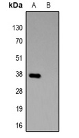 Anti-GST-tag Antibody