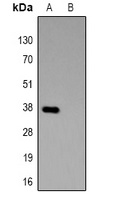 GST-tag antibody