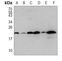 CXCL1 antibody