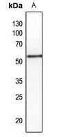 Anti-PTEN (Phospho-S380/T382/T383) Antibody