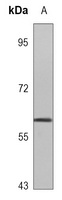 PHF1 antibody