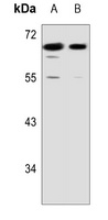 Anti-S6K1 Antibody
