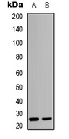 Anti-HMGB2 Antibody