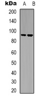 Anti-LTK Antibody