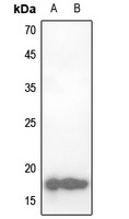 Anti-CBP20 Antibody