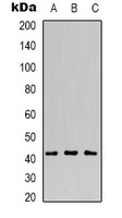 Anti-MVK Antibody