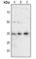 Anti-FOXE3 Antibody