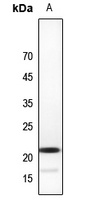 Anti-CBFB Antibody