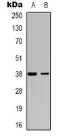 Anti-DOK6 Antibody