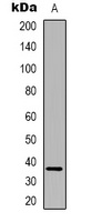 FAM84B antibody