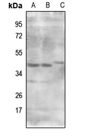 Anti-MRPS9 Antibody