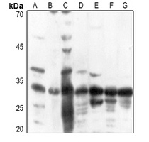 ATP5C1 antibody