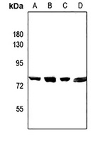 Anti-CEP78 Antibody