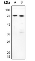 FUBP3 antibody