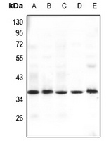 Anti-GHITM Antibody