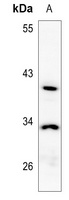 Anti-NXPH3 Antibody