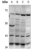 Anti-PABPC5 Antibody