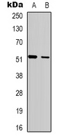 SH2D2A antibody