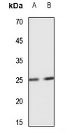 Anti-SCN4B Antibody