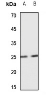 SCN4B antibody