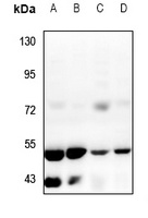 Anti-ZFYVE19 Antibody