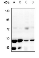 ZFYVE19 antibody