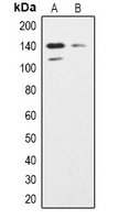 Anti-SHIP2 Antibody